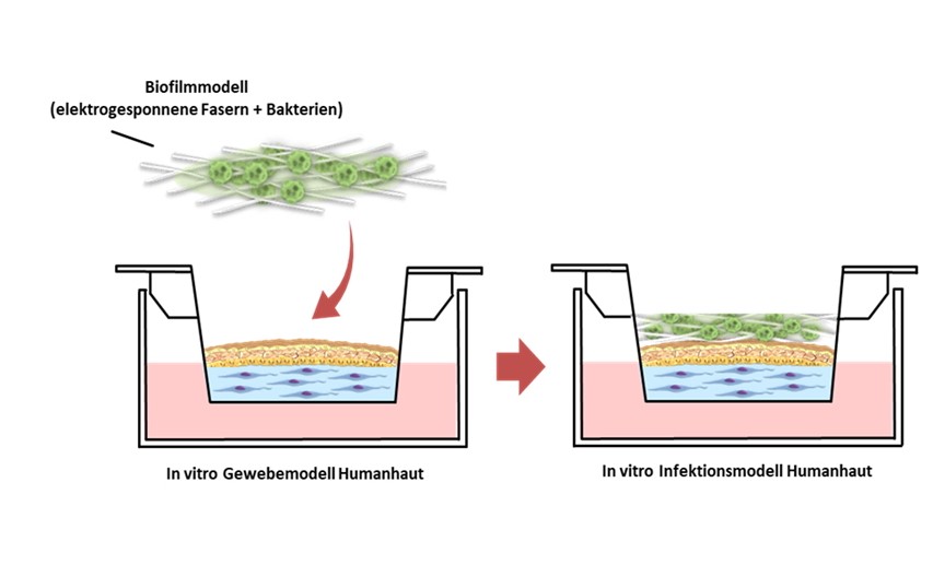 Bakterielle Gewebeinfektionen werden standardmäßig an Tiermodellen untersucht. Die Entwicklung eines robusten und universell einsetzbaren In-vitro-Modells eines bakteriellen Biofilms kann eine valide human-basierte Alternative zu Tierversuchen schaffen.